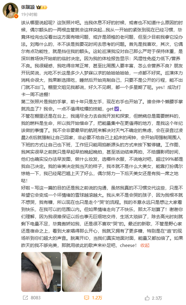 张靓颖自曝体检查出营养不良:额头血管莫名突起 伸懒腰手掌就流血