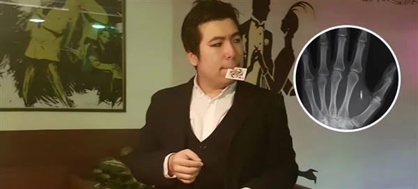 美国魔术师手掌植入芯片 但他忘记了密码