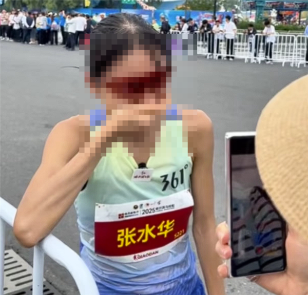 “最快女护士”张水华宣布辞职：丈夫全力支持 50天内赢得20万元奖金