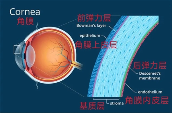 那些做了近视激光手术的人 后来怎么样了？