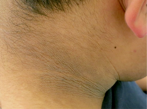 脖子总是黑黑的洗不干净？别大意 这可能是身体在求救